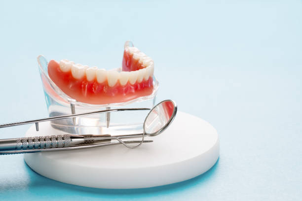 Dental Inlays and Onlays in Wabash, IN